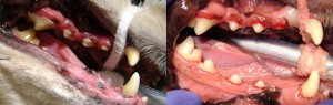A patient with moderate to severe tartar & gingivitis (before and after procedure)