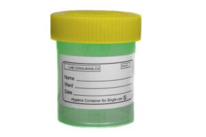 Yellow green specimen sample container